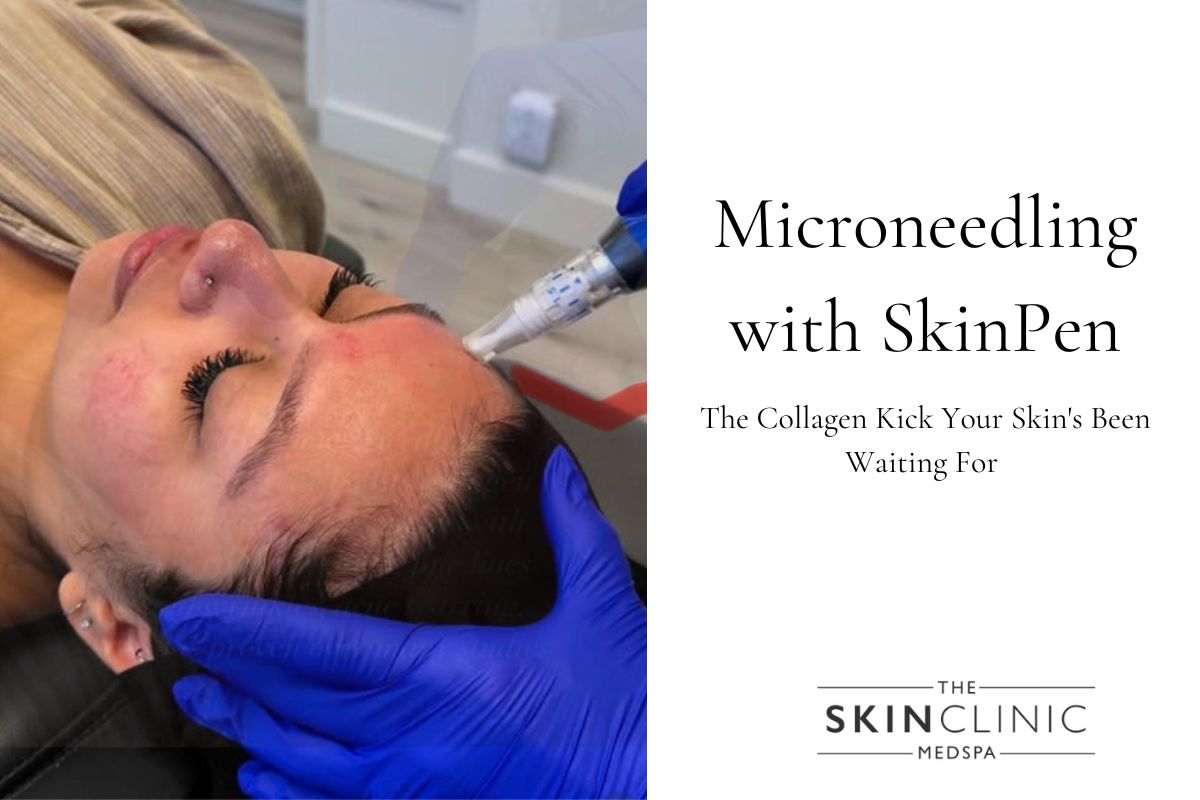 Microneedling with SkinPen in Scottsdale