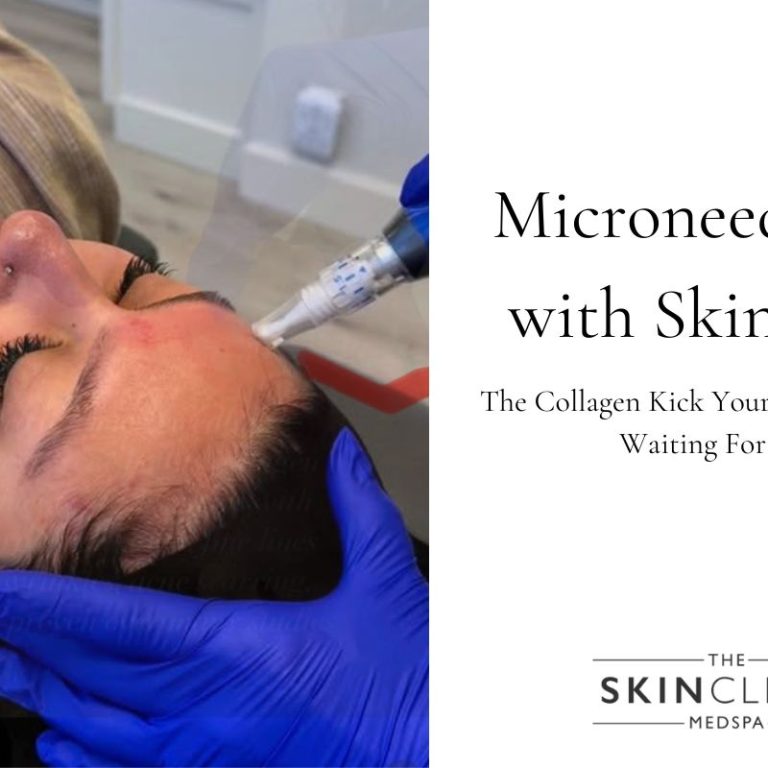 Microneedling with SkinPen in Scottsdale